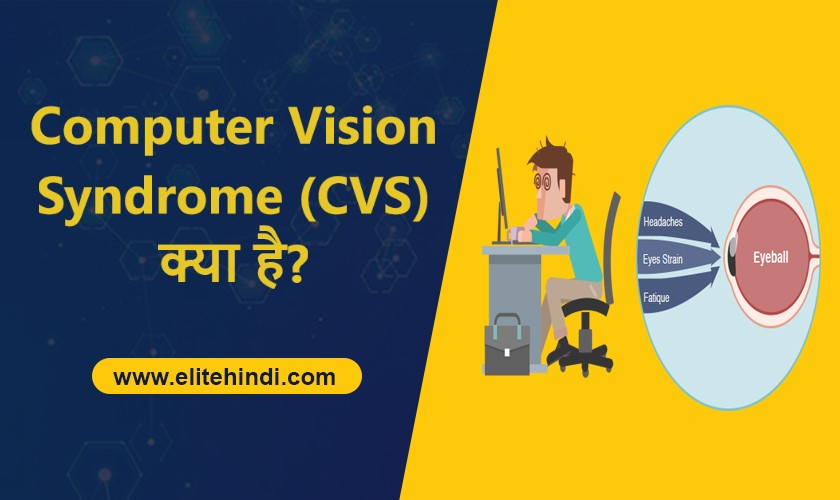 Computer Vision Syndrome(CVS)क्या है?